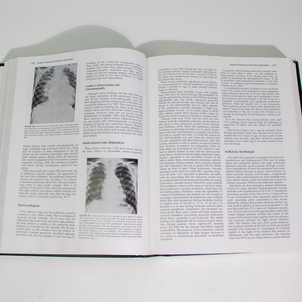 Surgery of the Chest, Sixth Edition, Volume II
